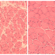 muscle cells salk